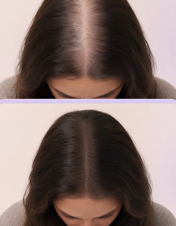Hair Growth