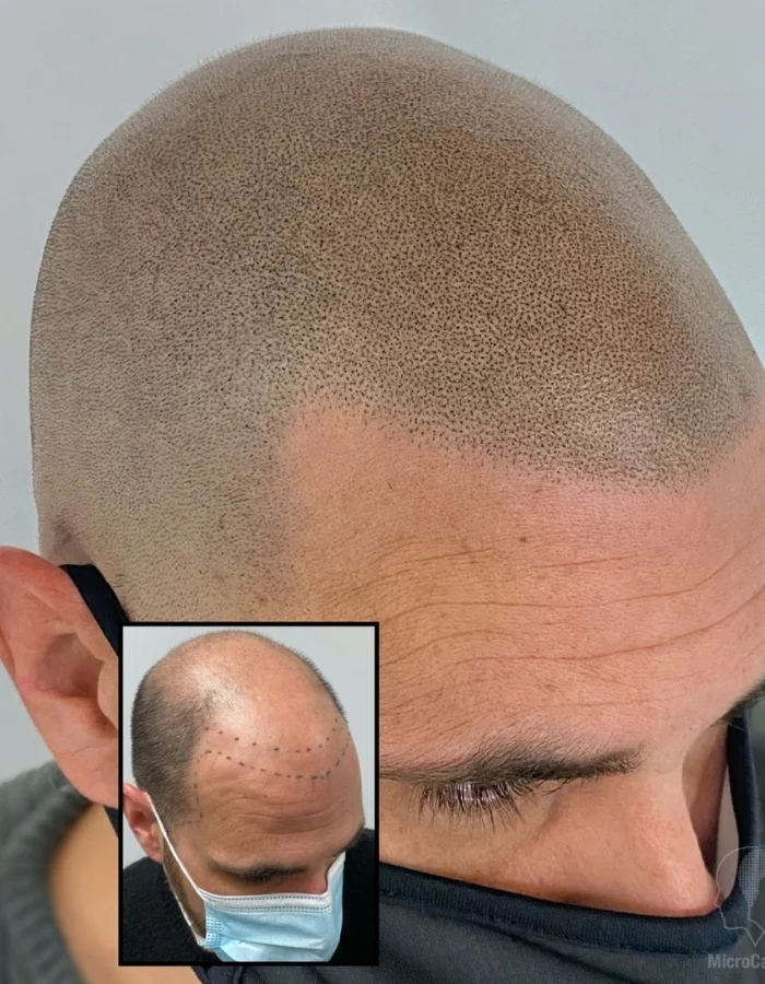 Hair Factors