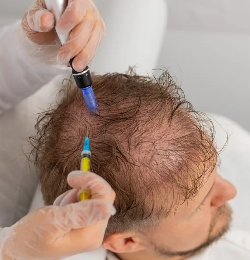 Mesotherapy & Scalp Treatments